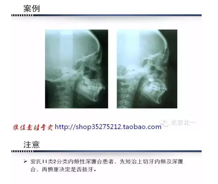 QQ圖片20150824093147.png QQ圖片20150824093147.png