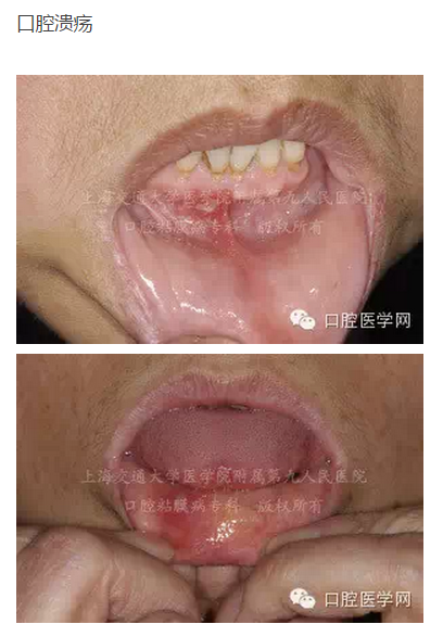 QQ圖片20150824140531.png QQ圖片20150824140531.png