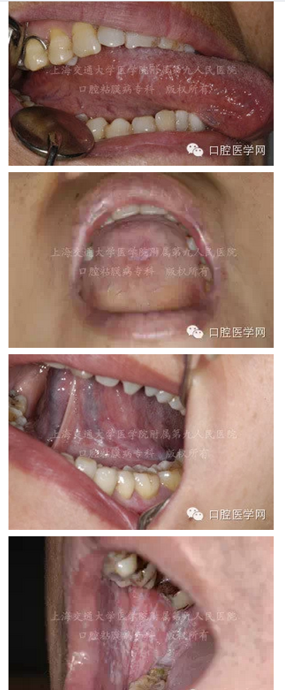 QQ圖片20150824140636.png QQ圖片20150824140636.png