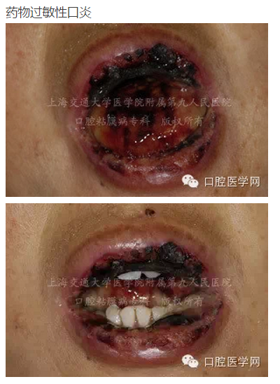 QQ圖片20150824140704.png QQ圖片20150824140704.png