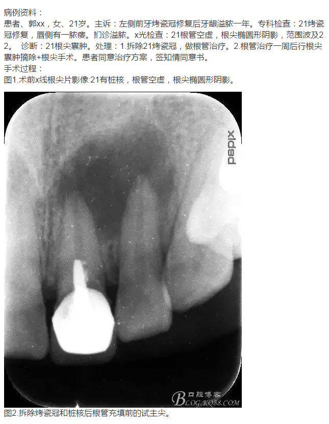 QQ圖片20150824152323.png QQ圖片20150824152323.png