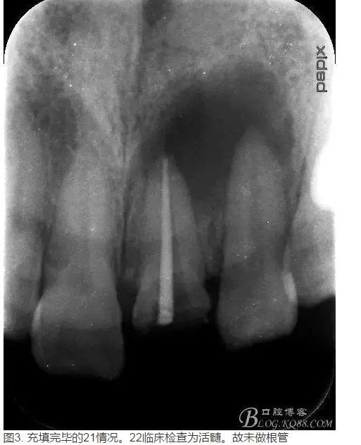 QQ圖片20150824152337.png QQ圖片20150824152337.png