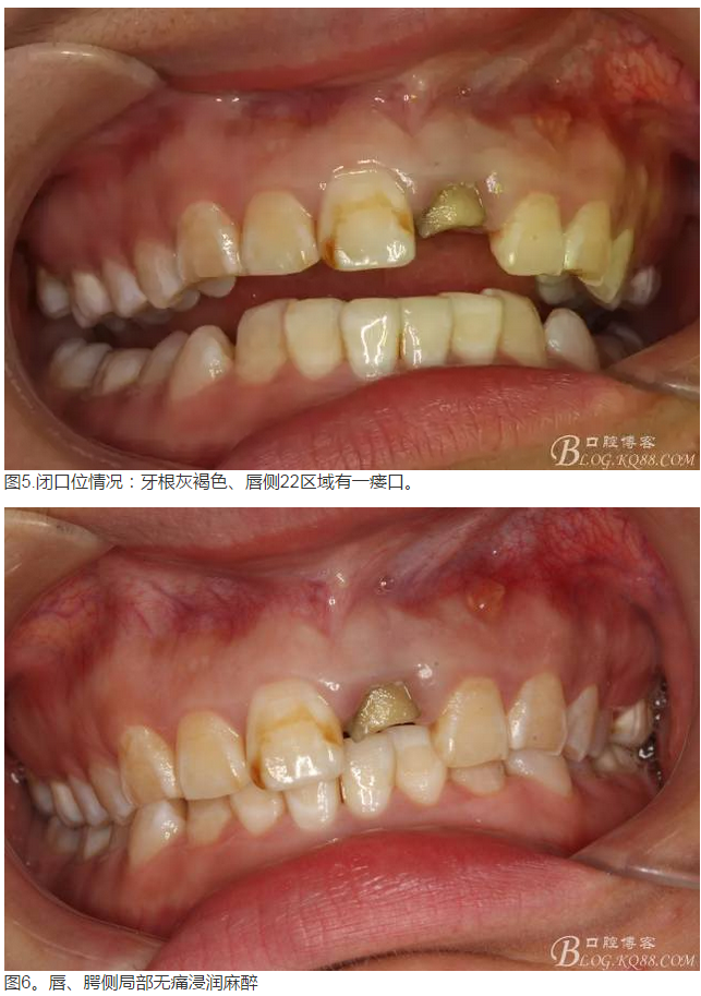 QQ圖片20150824152406.png QQ圖片20150824152406.png