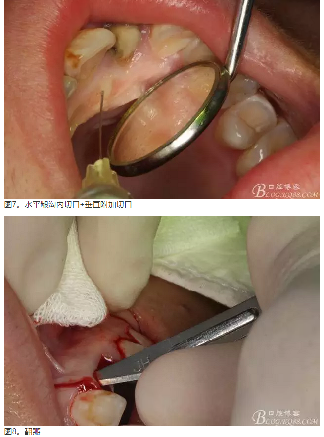 QQ圖片20150824152423.png QQ圖片20150824152423.png