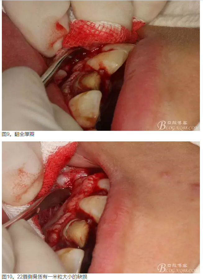 QQ圖片20150824152439.png QQ圖片20150824152439.png