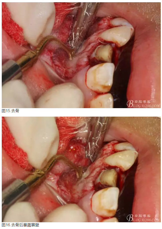 QQ圖片20150824152525.png QQ圖片20150824152525.png