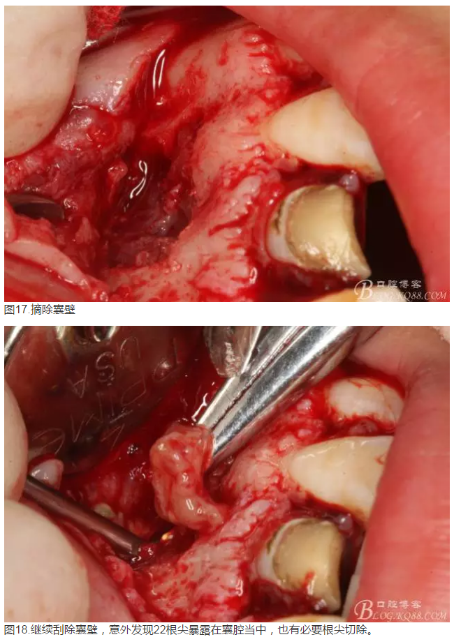 QQ圖片20150824152539.png QQ圖片20150824152539.png