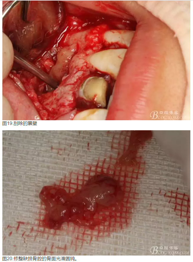 QQ圖片20150824152553.png QQ圖片20150824152553.png