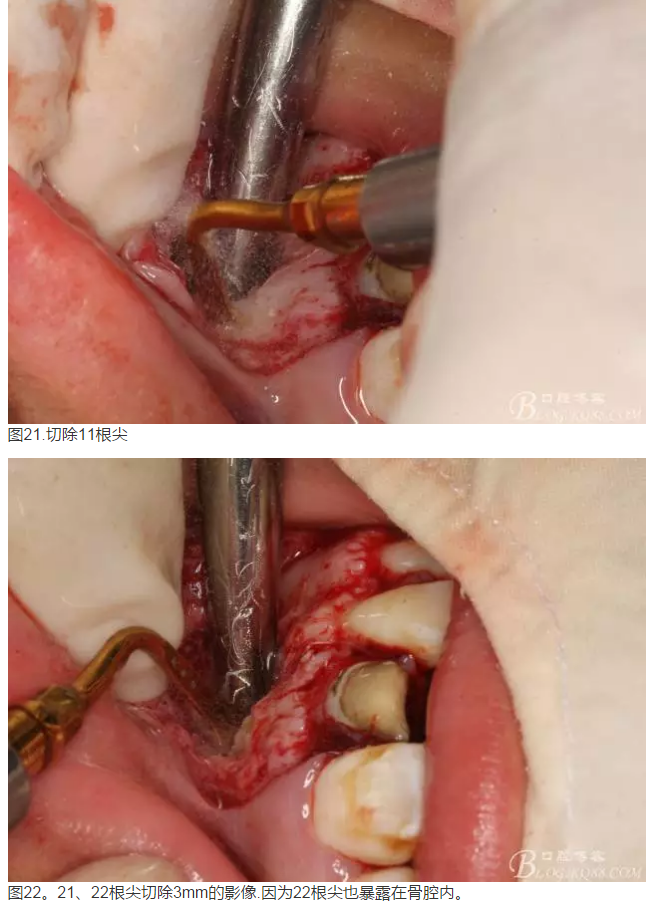 QQ圖片20150824152608.png QQ圖片20150824152608.png