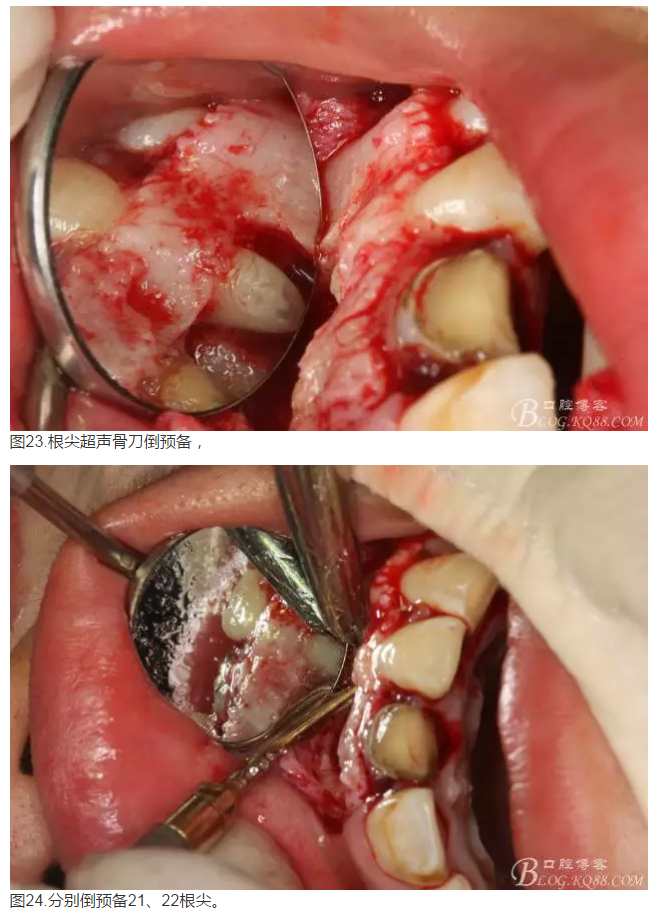 QQ圖片20150824152622.png QQ圖片20150824152622.png