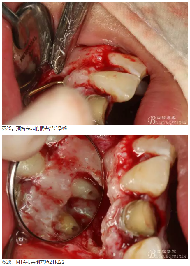 QQ圖片20150824152636.png QQ圖片20150824152636.png