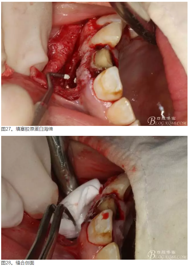 QQ圖片20150824152649.png QQ圖片20150824152649.png