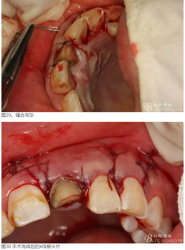 QQ圖片20150824152705.png QQ圖片20150824152705.png