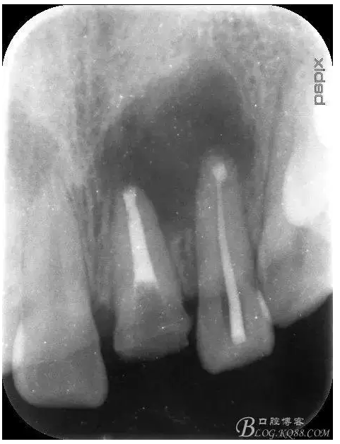 QQ圖片20150824152731.png QQ圖片20150824152731.png