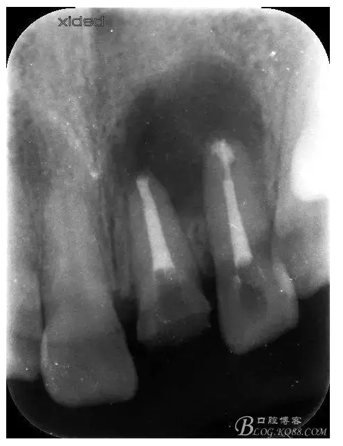 QQ圖片20150824152743.png QQ圖片20150824152743.png