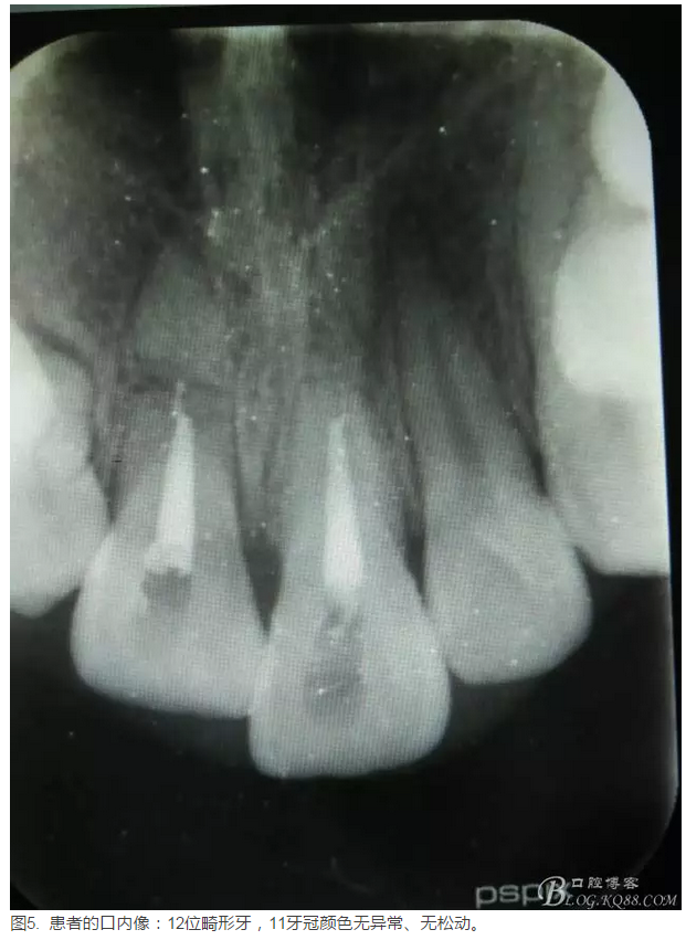 QQ圖片20150825100954.png QQ圖片20150825100954.png