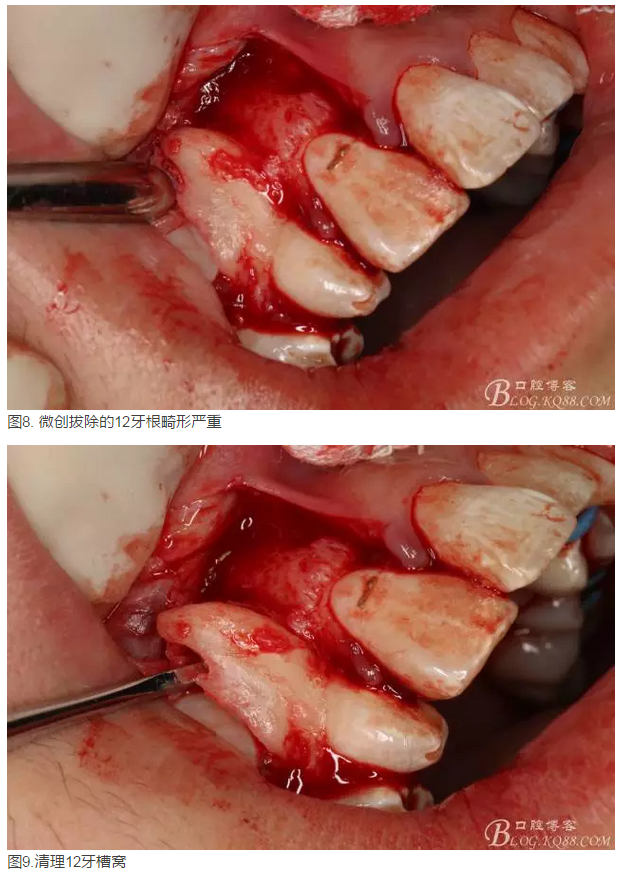 QQ圖片20150825101021.png QQ圖片20150825101021.png