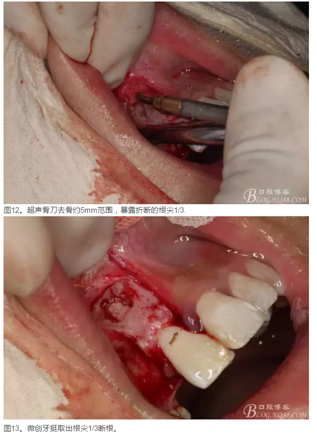 QQ圖片20150825101058.png QQ圖片20150825101058.png