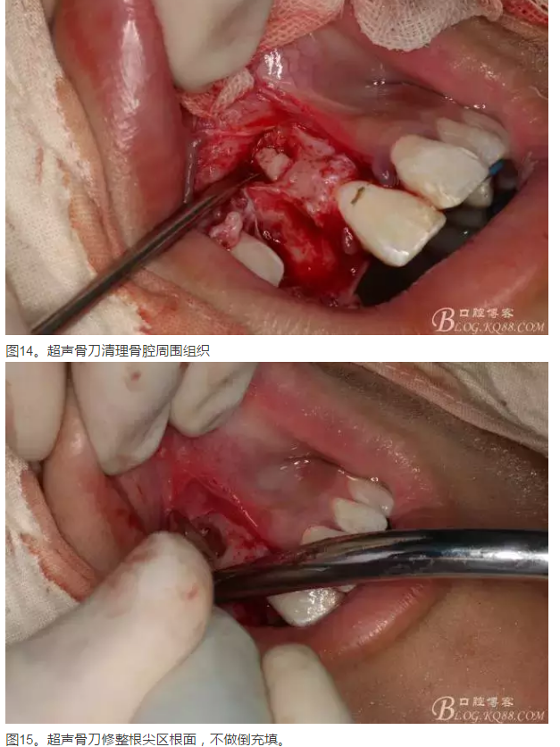 QQ圖片20150825101110.png QQ圖片20150825101110.png