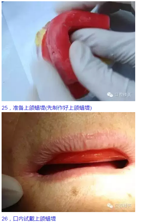 QQ圖片20150825103807.png QQ圖片20150825103807.png