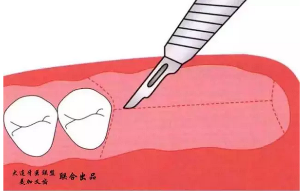 QQ圖片20150825110046.png QQ圖片20150825110046.png