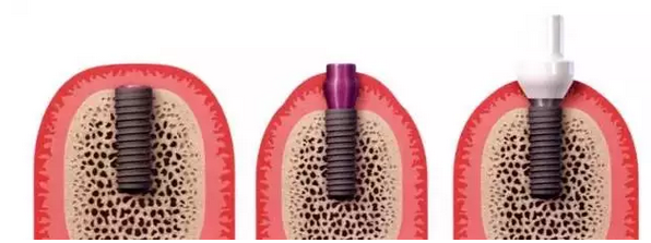 QQ圖片20150825110107.png QQ圖片20150825110107.png