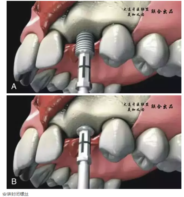 QQ圖片20150825140635.png QQ圖片20150825140635.png