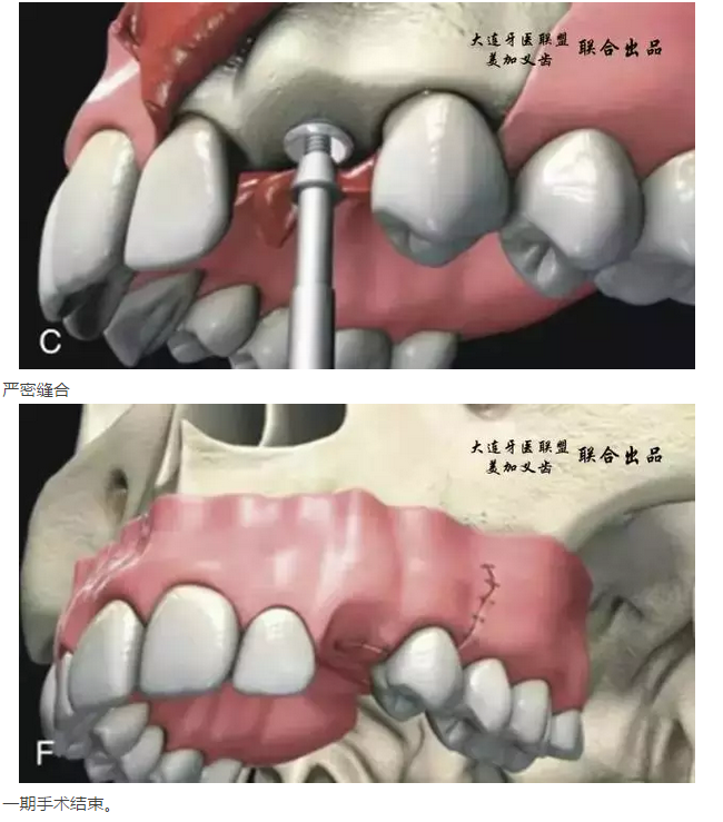 QQ圖片20150825140653.png QQ圖片20150825140653.png