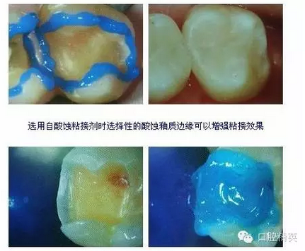 QQ圖片20150825173104.png QQ圖片20150825173104.png