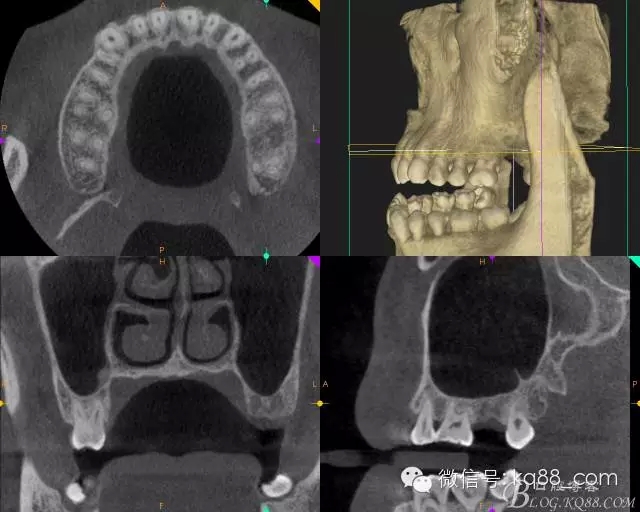 1114.webp.jpg 1114.webp.jpg