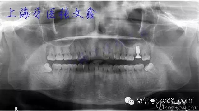 1115.webp.jpg 1115.webp.jpg