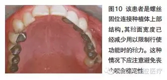 1554.webp.jpg 1554.webp.jpg