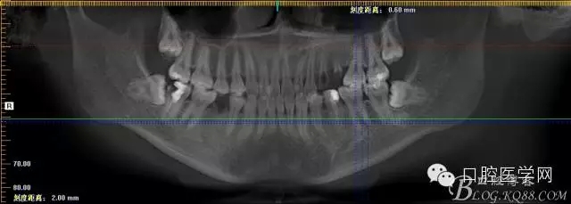 81.webp.jpg 81.webp.jpg