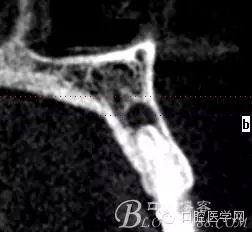 82.webp.jpg 82.webp.jpg