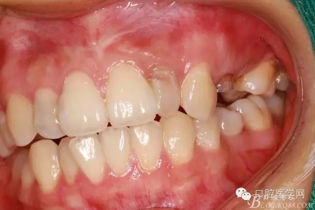 84.webp.jpg 84.webp.jpg