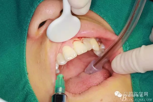 88.webp.jpg 88.webp.jpg