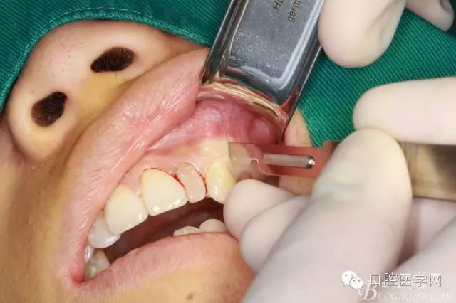 89.webp.jpg 89.webp.jpg