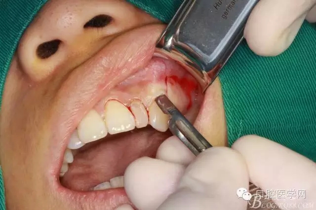 90.webp.jpg 90.webp.jpg