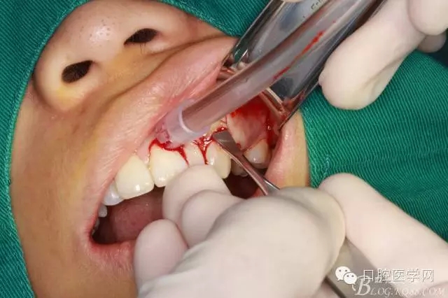 91.webp.jpg 91.webp.jpg