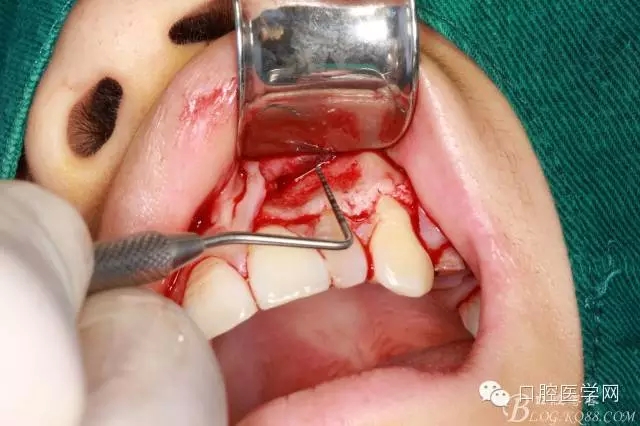 94.webp.jpg 94.webp.jpg