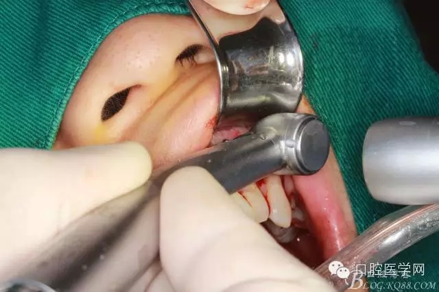 95.webp.jpg 95.webp.jpg