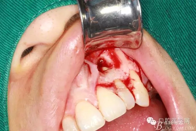 99.webp.jpg 99.webp.jpg