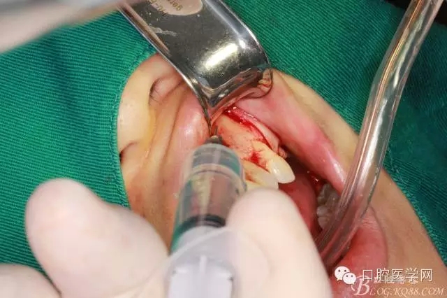 100.webp.jpg 100.webp.jpg