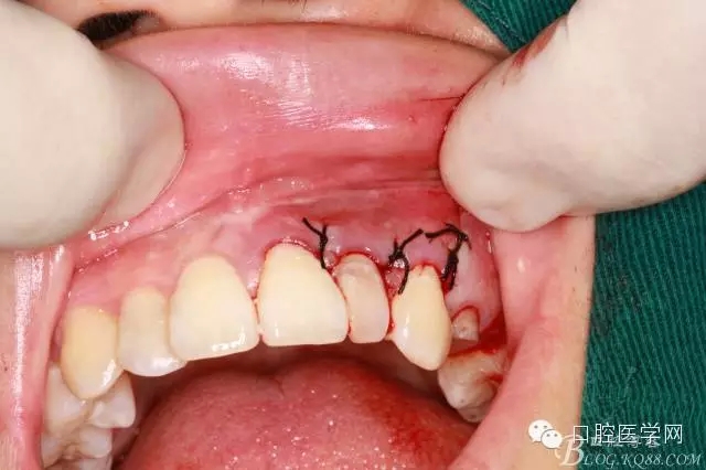 104.webp.jpg 104.webp.jpg