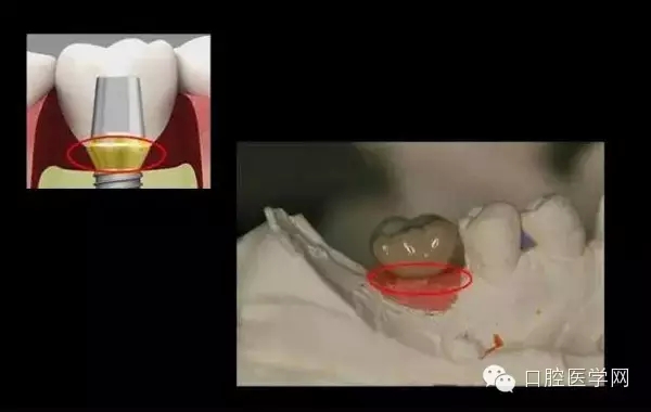 93.webp.jpg 93.webp.jpg