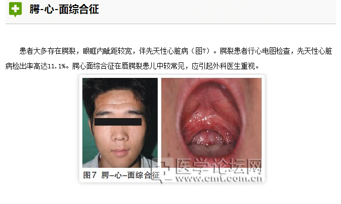 口腔疾病與全身系統(tǒng)性疾病的關系 口腔疾病與全身系統(tǒng)性疾病的關系