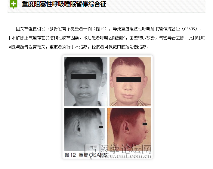 口腔疾病與全身系統(tǒng)性疾病的關系 口腔疾病與全身系統(tǒng)性疾病的關系