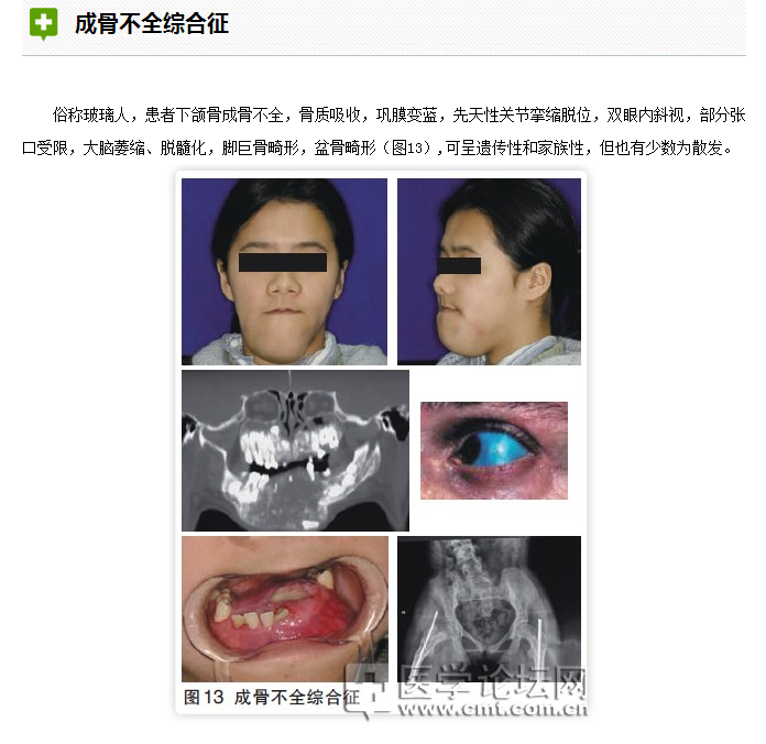 口腔疾病與全身系統(tǒng)性疾病的關系 口腔疾病與全身系統(tǒng)性疾病的關系