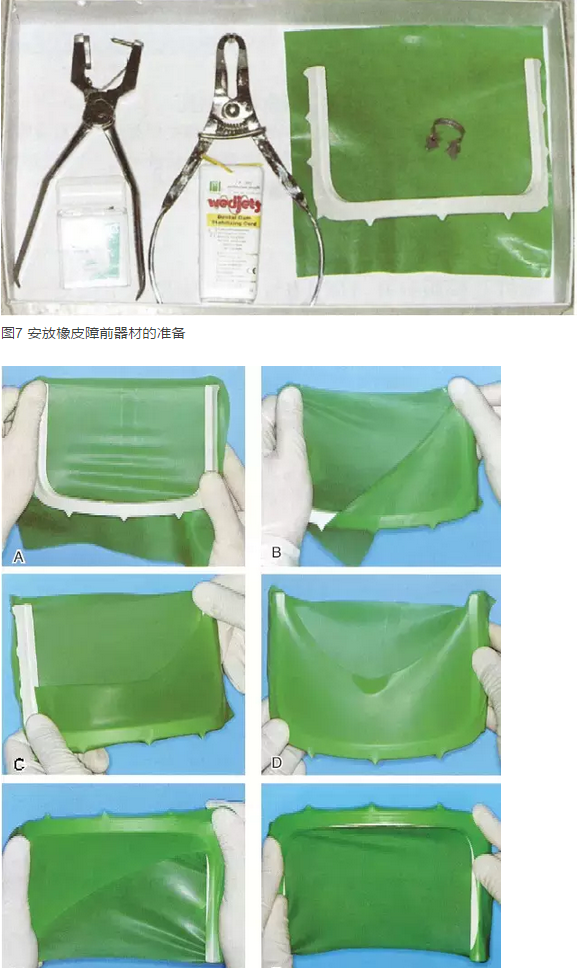 橡皮障隔離之單顆牙隔離方法——陳智教授 橡皮障隔離之單顆牙隔離方法——陳智教授