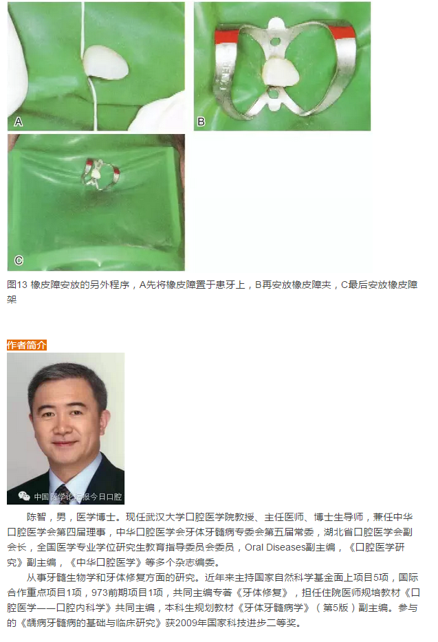 橡皮障隔離之單顆牙隔離方法——陳智教授 橡皮障隔離之單顆牙隔離方法——陳智教授